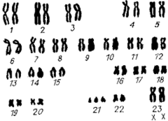 03001213-fcbb-162x117.png