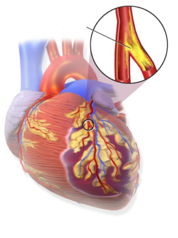 030013i5-1d07-260x347.png