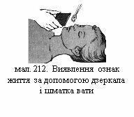 Результат пошуку зображень за запитом мал. 212. Виявлення ознак життя за допомогою дзеркала і шматка вати