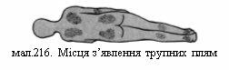 Результат пошуку зображень за запитом 216. Місця з’явлення трупних плям