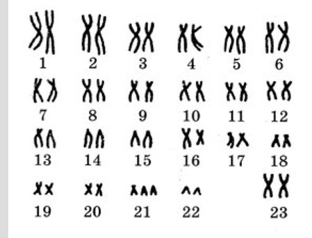 03005abl-6b8f-449x343.png