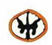 0300a2nd-dba1-179x154.png