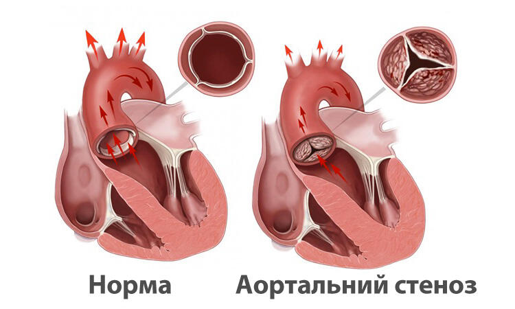 0300dplq-c265-750x450.jpg