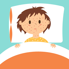 How to respond to — and prevent — a measles outbreak