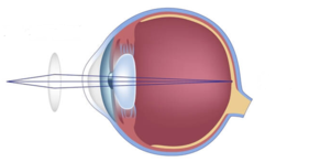 0300ldxu-97f1-281x147.png