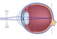 0300ldy6-f687-218x151.png