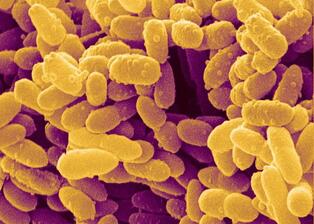 Erwinia Bacteria, Sem Greeting Card for Sale by Power And Syred