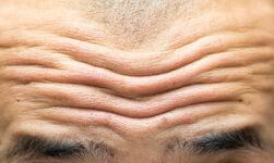 Deep forehead wrinkles early sign of cardiovascular disease, according to German scientists | Daily Mail Online