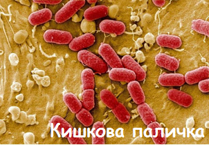 03017h44-158b-302x210.png