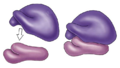 03018sor-ba24-240x137.png