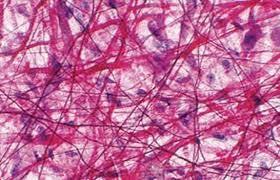 0301br0d-a0d3-280x180.jpg
