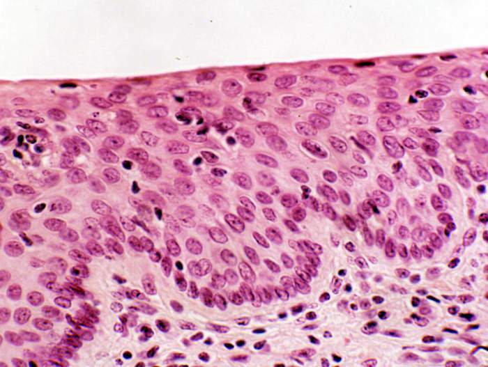 0301ccbl-3f3b-700x527.jpg