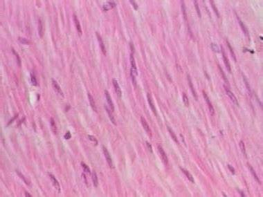0301dmlt-109b-380x285.jpg
